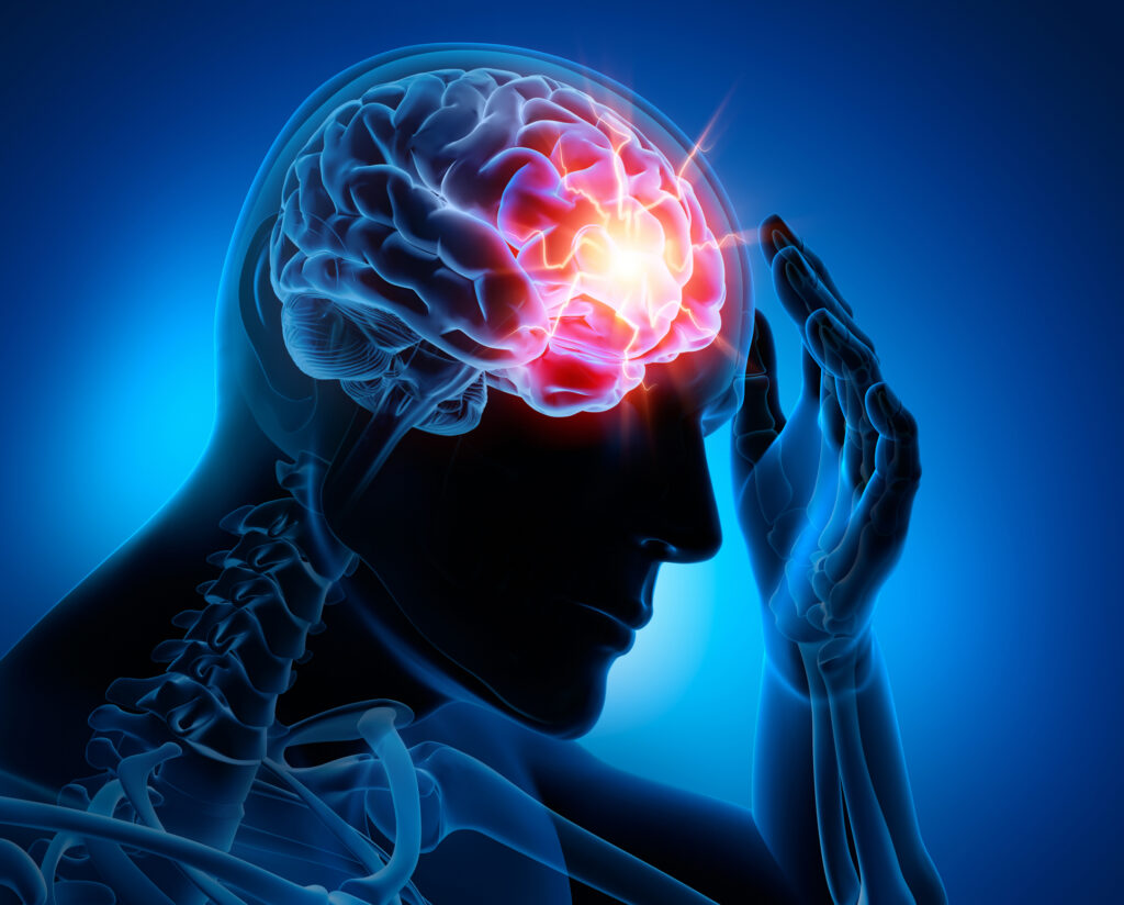 What Are the Early Signs of a Brain Injury After an Accident?