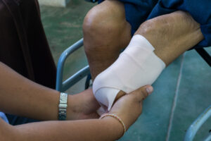 Why Choose Malone Law Medical Malpractice and Severe Injury Lawyers to Help After an Amputation Injury in Smyrna, GA?