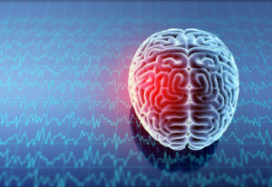 What Are the Two Main Types of Stroke?